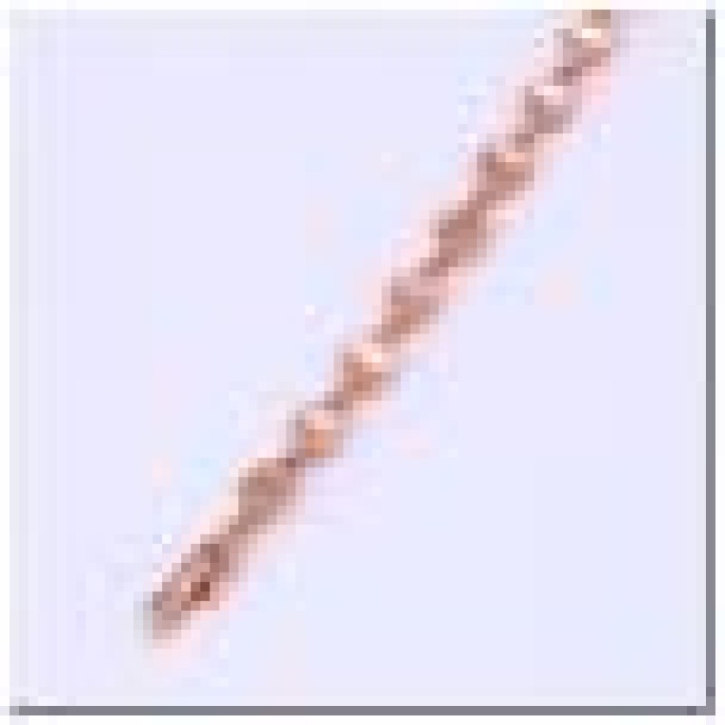 Apzeltīta rokassprādze