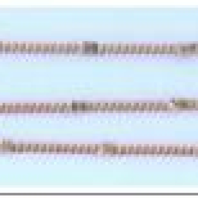 Apzeltīta rokassprādze Klasisks pinums ar saules staru Fancy posmiem