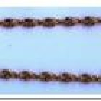 Apzeltīta rokassprādze