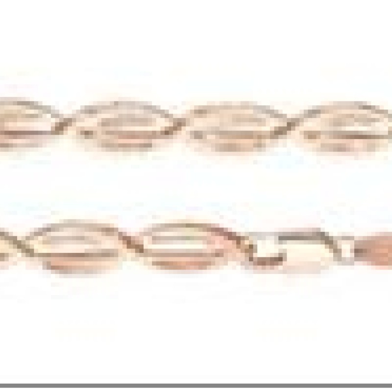 Apzeltīta rokassprādze