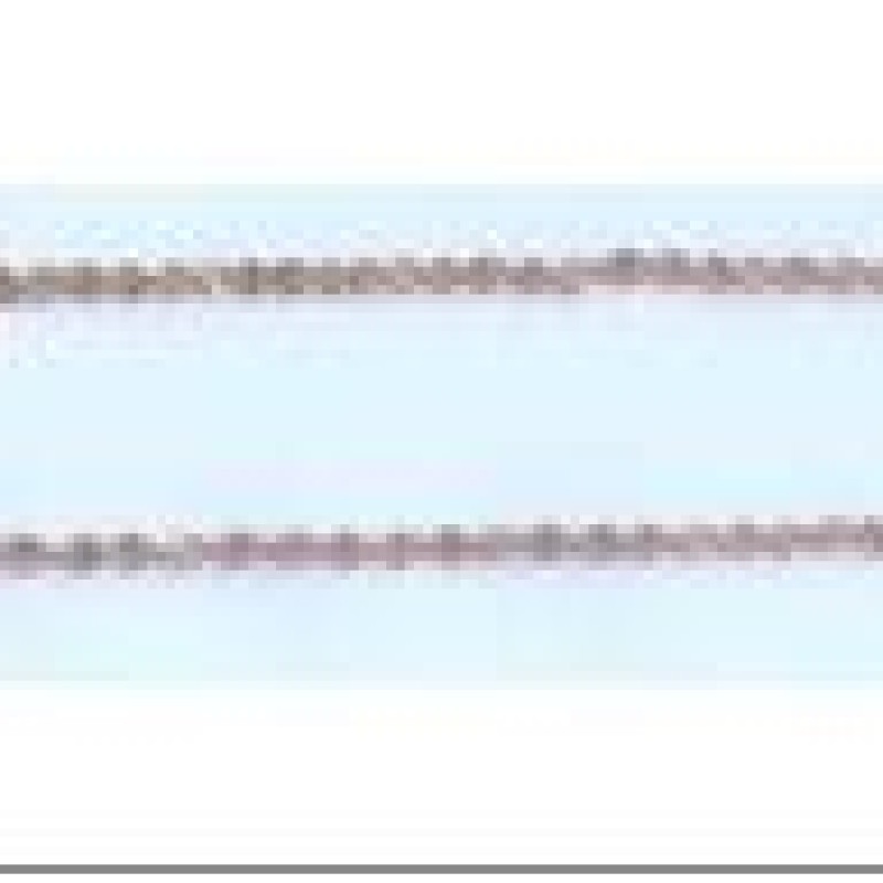 Apzeltītā ķēdīte Singapūras dubulto posmu pinums