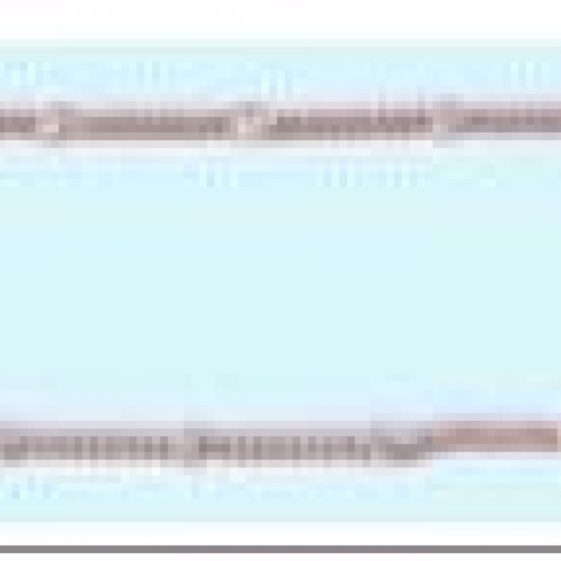 Apzeltītā ķēdīte Klasisks pinums ar saules staru Fancy posmiem