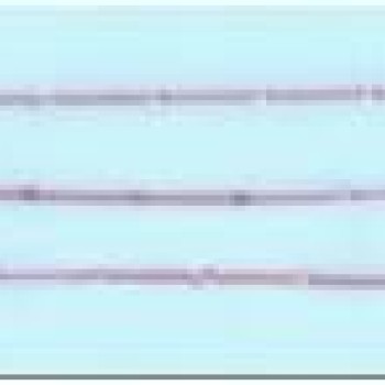 Apzeltītā ķēdīte Klasisks pinums ar saules staru Fancy posmiem